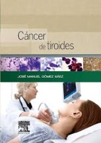 Image of Cáncer de tiroides